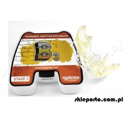 Aparat MRC B3 retencja za pomocą alignerów - elastyczny aparat ortodontyczny